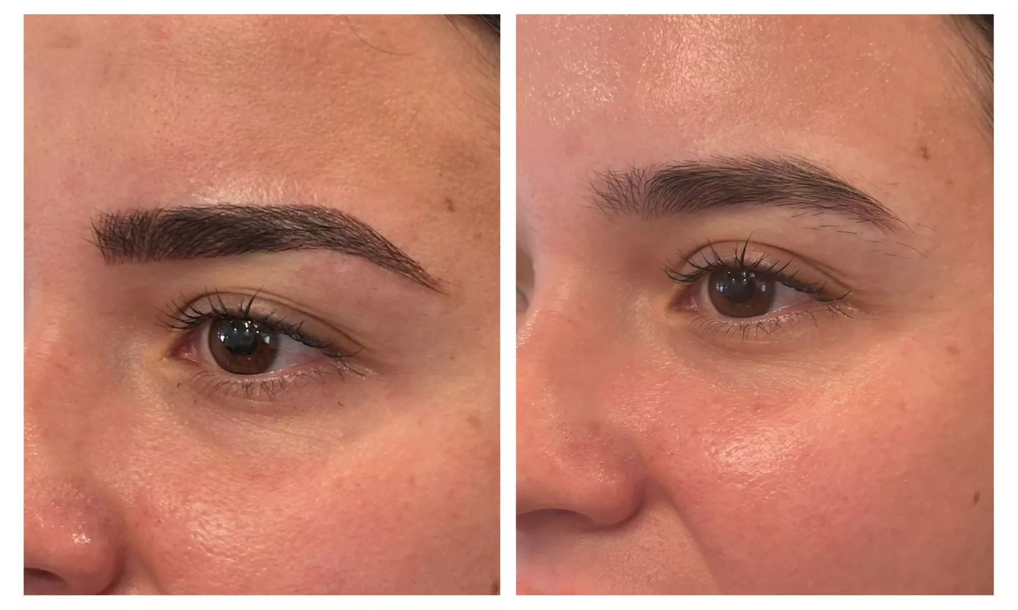 Eyebrow Microblading and Touch-Up for Perfect Brows