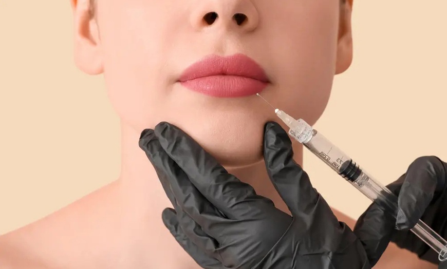 Image 1: One Syringe of Restylane Kysse or Restylane Lyft or Both and More