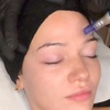 Image 1: Refresh Your Skin with One  or Two Sessions of Microneedling 