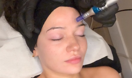 One session of microneedling - Sisters Beauty Studio