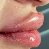 Image 6: Smooth, Plump & Perfect: Versa Enhancements at Divaa Beauty