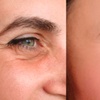 Image 1: 10, 20, 40 Units of Botox or 1 Juvederm Syringe -Up to 45% Off