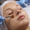 Image 1: Get 1x, 3x, or 5x Chemical Peel Session for Face, Neck & Decolletage