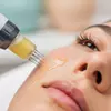 One or Two Microneedling Sessions with PRF at HOPE Dentistry Suwanee - Up to 61% Off