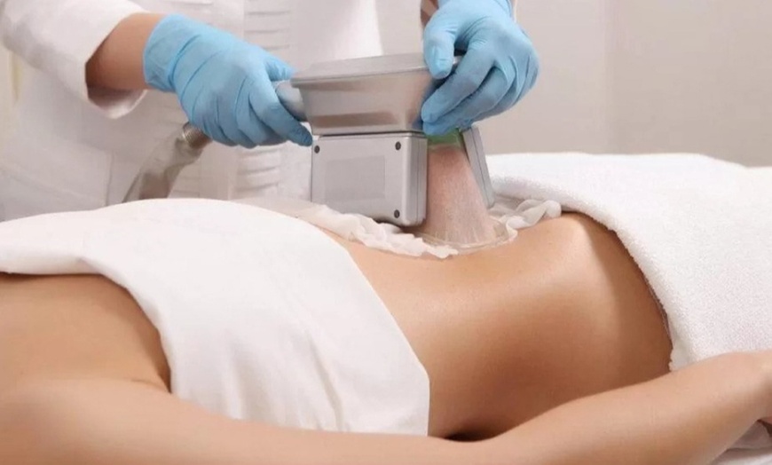 Image 4: 1 o 2 sesiones de 1 hora de criolipólisis doble con masaje drenante