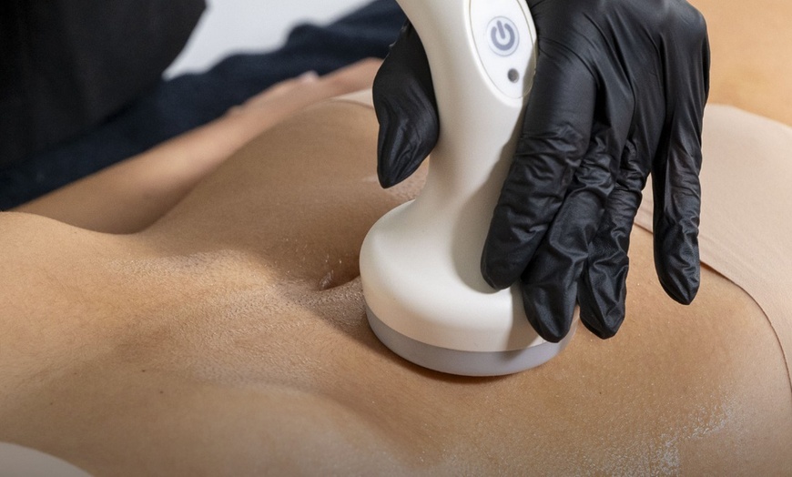 Image 3: Skin Tightening for Legs, Abs, Face Toning & Sculpting session/ More