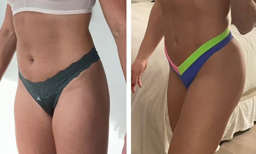 Image 4: One or Three 90-Minute Brazilian Lymphatic Drainage Sessions