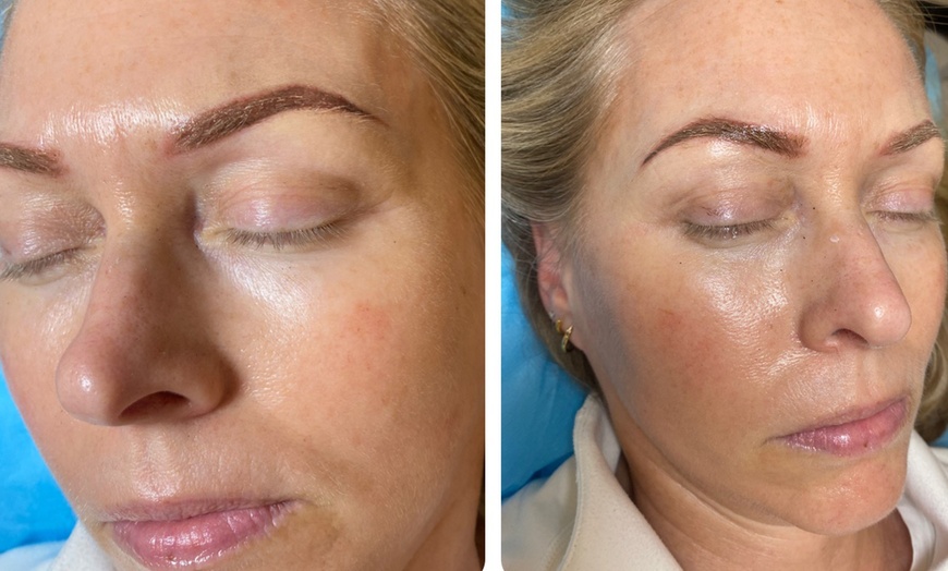 Image 4: Enhance Your Look With Microblading, Lip Blush or Eyeliner Tattoo 