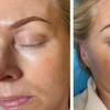 Image 4: Enhance Your Look With Microblading, Lip Blush or Eyeliner Tattoo 