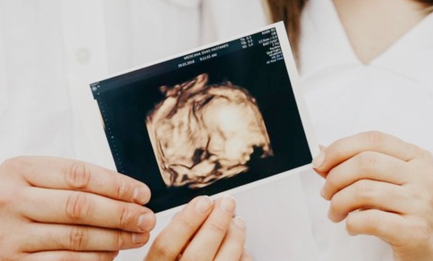 Image 2: 4D Baby Scan or Early Assurance Pregnancy Scan at Imaginatal Liverpool