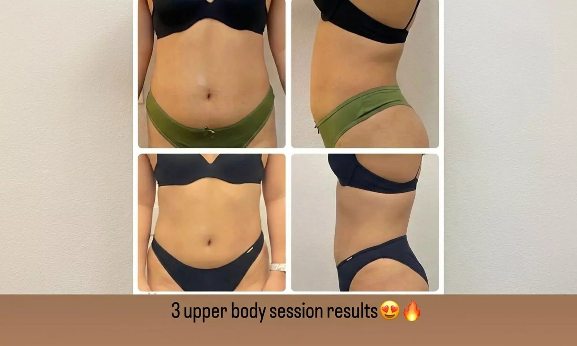 ultrasonic cavitation treatments and b12 injections Therapy Med Spa Chicago Ultrasonic Fat Cavitation PHX |