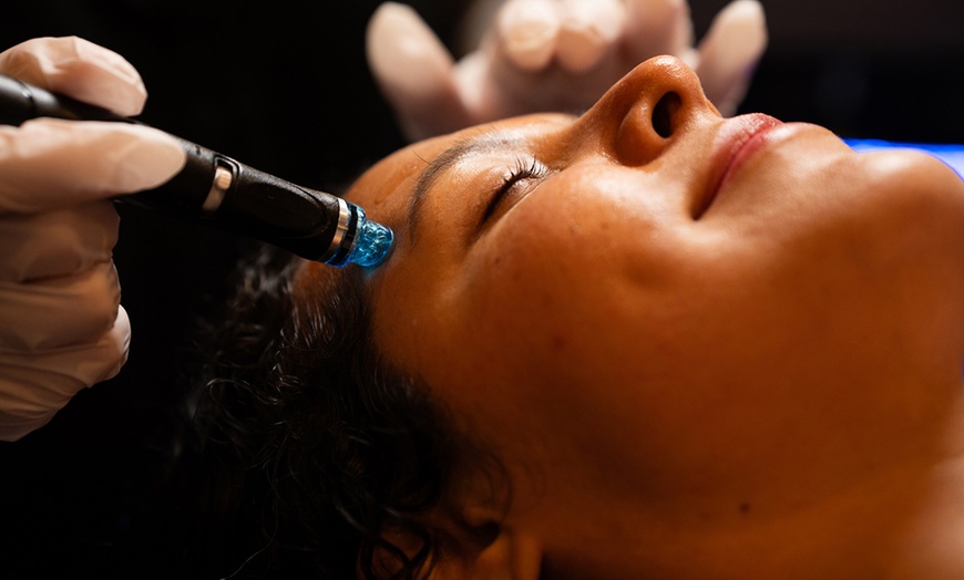 Image 3: Hydrate and Glow with Signature HydraFacials in Las Vegas
