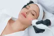 One or Three Microneedling with Optional PRP or Stem Cell Microneedling (Up to 65% Off) - Second Medium