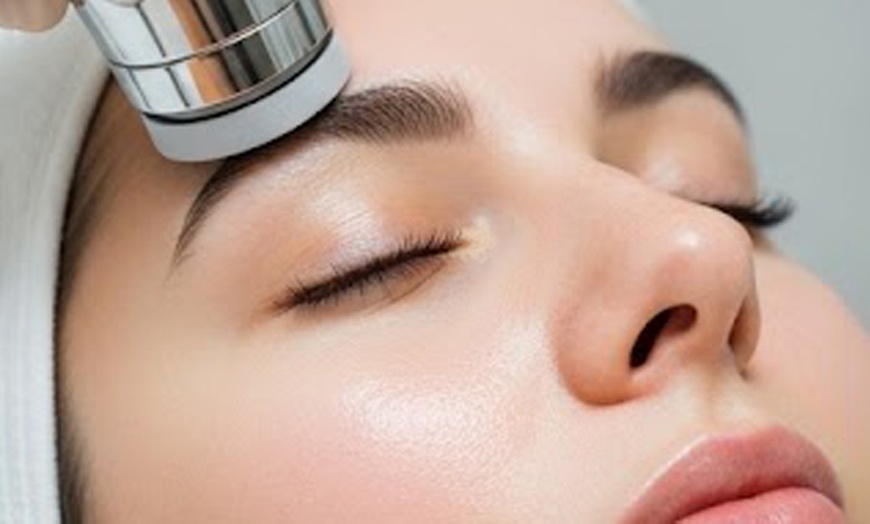 Image 3: Refresh Your Skin with Classic Microdermabrasion or Facial