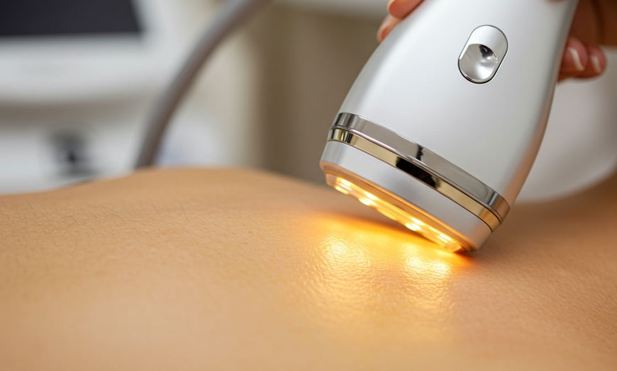 Image 1: One, Two, or Three Skin Tightening Radio Frequency with HydraFacial
