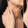 Image 3: Botox Treatments for Forehead, Crow Feet, Lip Flip, or Jawline Areas