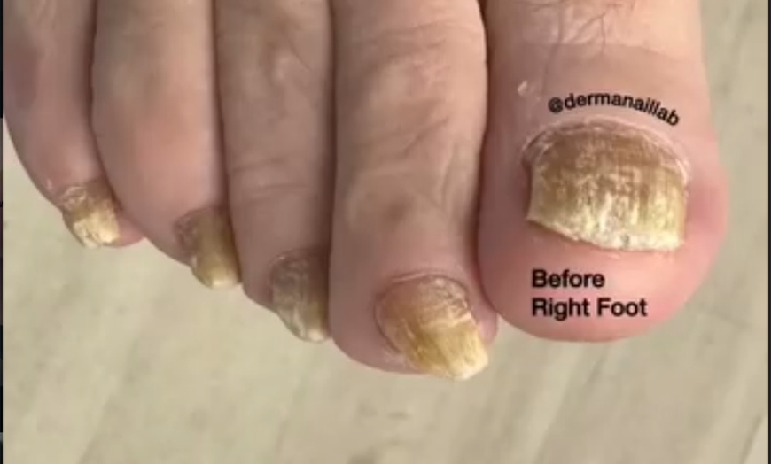 Image 6: Luxury Gel Manicure, Pedicure & Medi-Pedi Package 