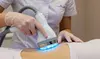 Up to 85% Off Six Laser Hair Removal Sessions for Small to Large or Brazilian Area at Derma Laser Center