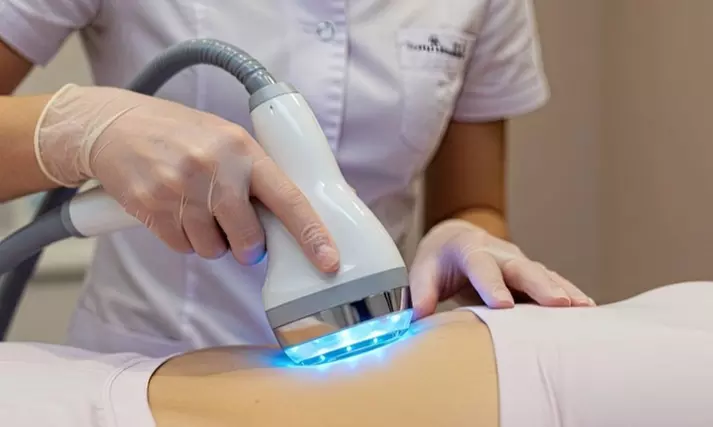Six Laser Hair Removal Sessions at Derma Laser, Small to Large Area