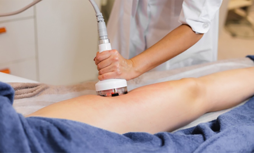 Image 2: 2, 4 o 6 sesiones de tratamiento reductor con cavitación y lipolaser 