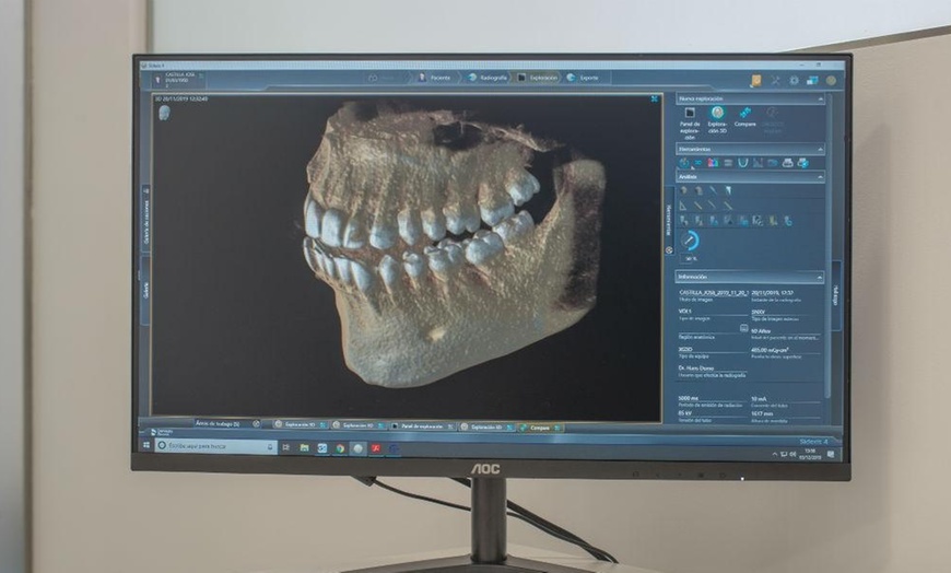 Image 1: TAC dental con estudio 3D