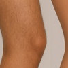 Image 3: 6 Laser Hair Removal Sessions-Small, Medium, Large or Extra Large Area
