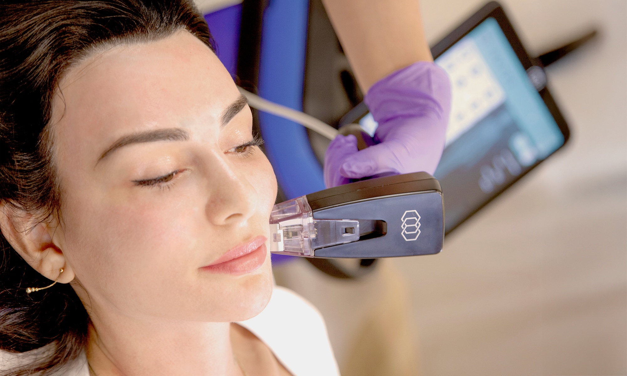 Morpheus8 Face & Neck, Two-Session Option, and Abdomen or Butt Session