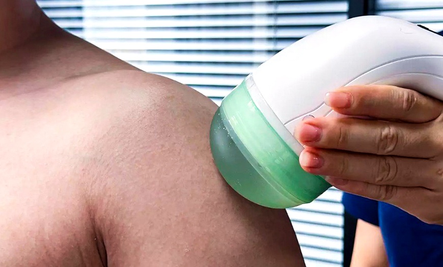 Image 3: One Shockwave Therapy Session for 1 or 2 Areas w/ Consultation & Exam