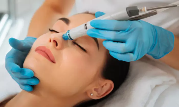 Rejuvenate Your Skin with HydraFacial or Lymphatic Facial at Vitality Vision Med Spa & Wellness (Up to 35% Off) - Primary Image