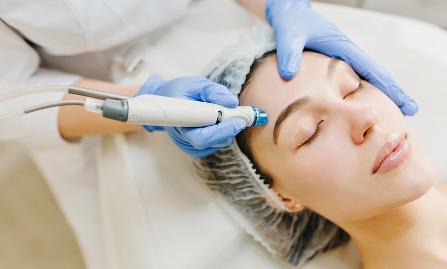 Image 2: 1 o 2 sesiones de microlifting facial con vitaminas con Dermapen