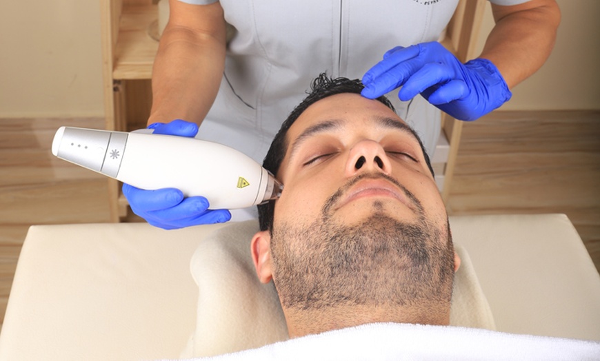 Image 2: Up to 48% Off on Facial at Olesthetic
