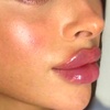 Image 9: Revanesse Versa Dermal Filler: Natural Lip & Facial Enhancement