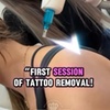 Image 1: Refresh with 3 Laser Tattoo Removal Sessions for Small, Medium, or Large Areas Up to 45% Off At The Spa Associate