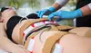 Up to 82% Off on Lipo - Non-Invasive Laser-iLipo at Sondrea Aesthetic Lounge: ''The Ultimate Ladies Den''