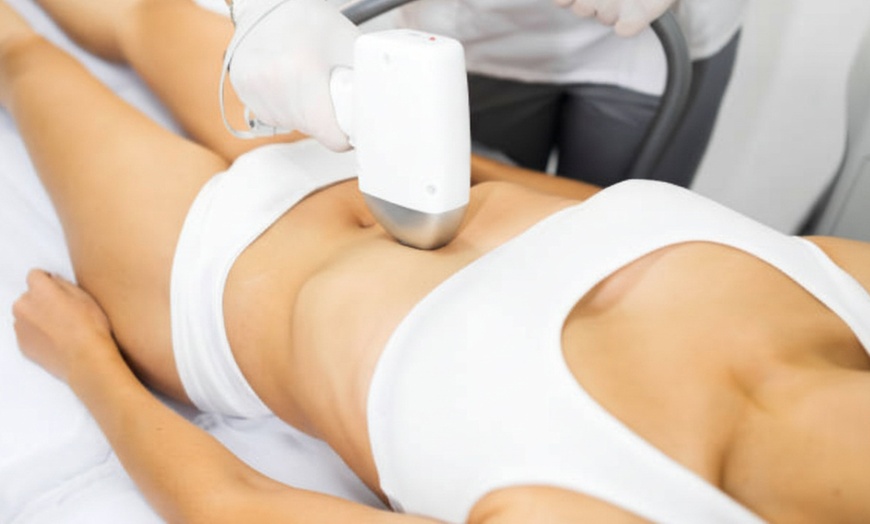 Image 8: 1, 3 o 6 sesiones de depilación láser en zona a elegir