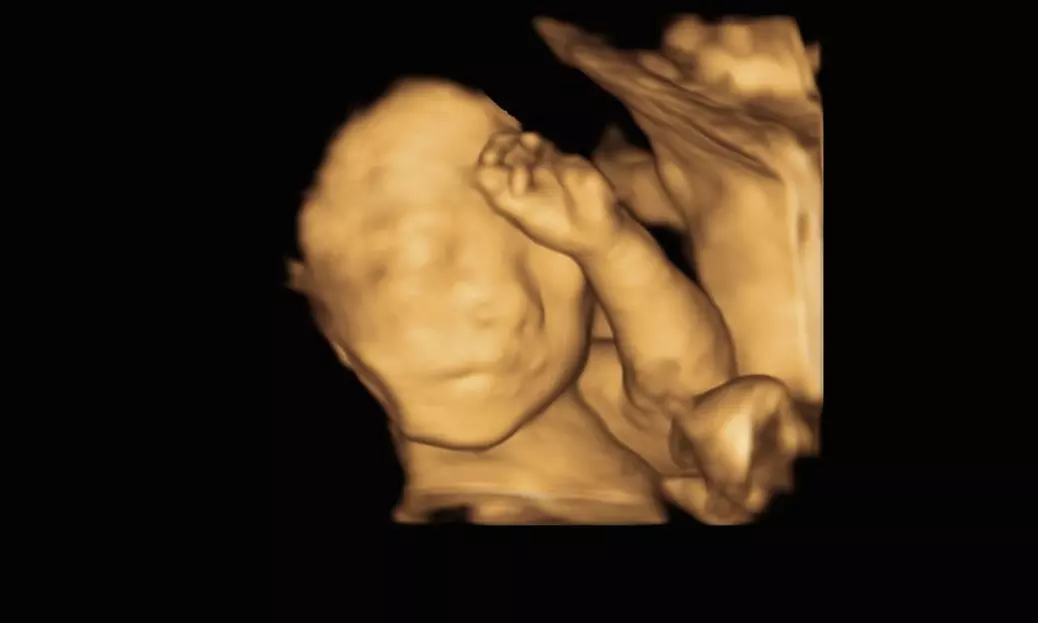 Capture Baby's First Moments with 3D/4D Ultrasound