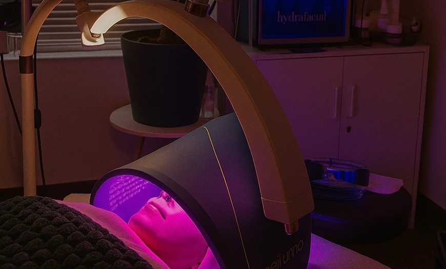 Image 2: Up to 64% Off on Microdermabrasion at Bermuzki Spa