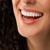 Image 1: Teeth Whitening Sessions with Multiple Treatments