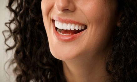 Signature Smile Brightening (Up to 8 Shades Whiter) - Moisturizd Day Spa