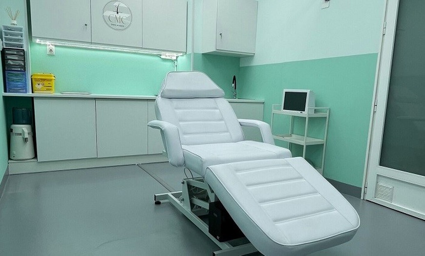 Image 3: Sesión de plasma pen para lunares, cicatrices o verrugas para 1