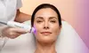One, Two, or Three Non-Invasive Face Lift with Therma Lift Radio-Frequency Skin Tightening (Up To 55% Off)