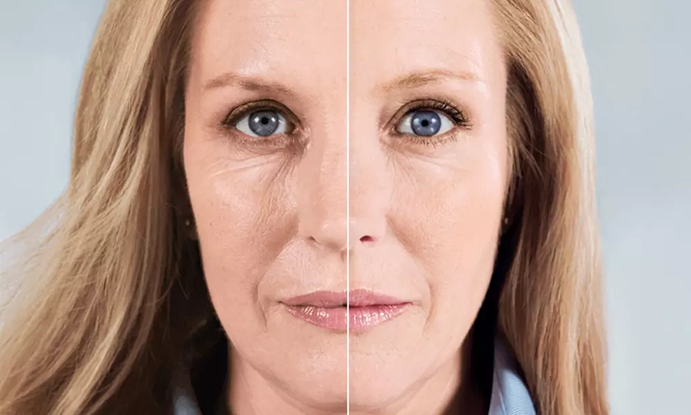 Sculpt, Lift & Rejuvenate with Sculptra Collagen Treatments