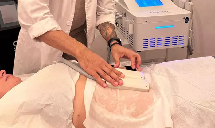 Reduce la grasa con hasta 2 sesiones de criolipólisis y EMSculpt