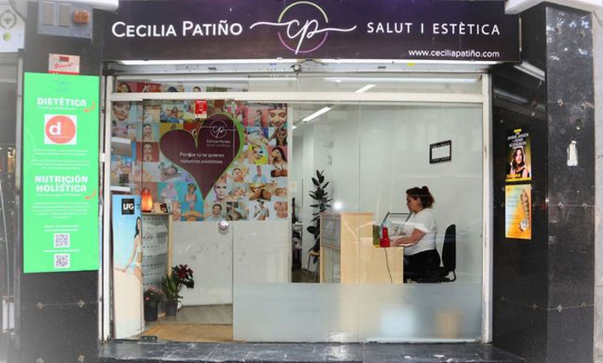 Image 11: Limpieza facial con opción a radiofrecuencia y tratamientos extra