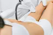 Up to 50% Off on Laser Hair Removal at Radiant Touch Skin Care Bar - Second Medium