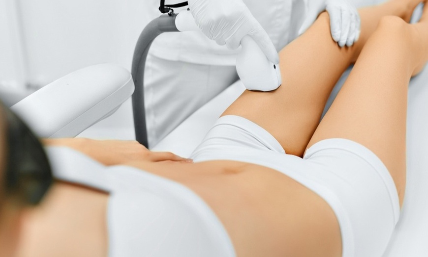 Image 2: Up to 50% Off on Laser Hair Removal at Radiant Touch Skin Care Bar