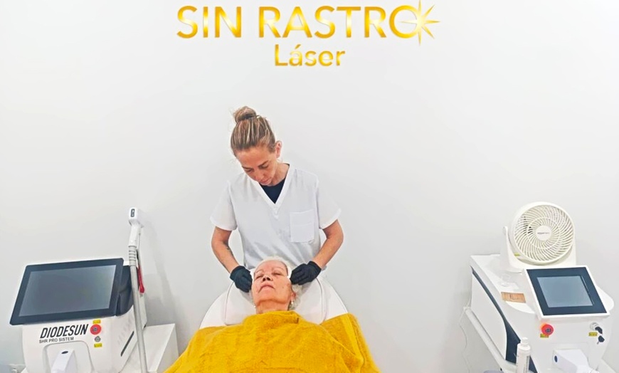 Image 2: 1 o 3 sesiones de láser para fotorejuvenecimiento y opción a peeling