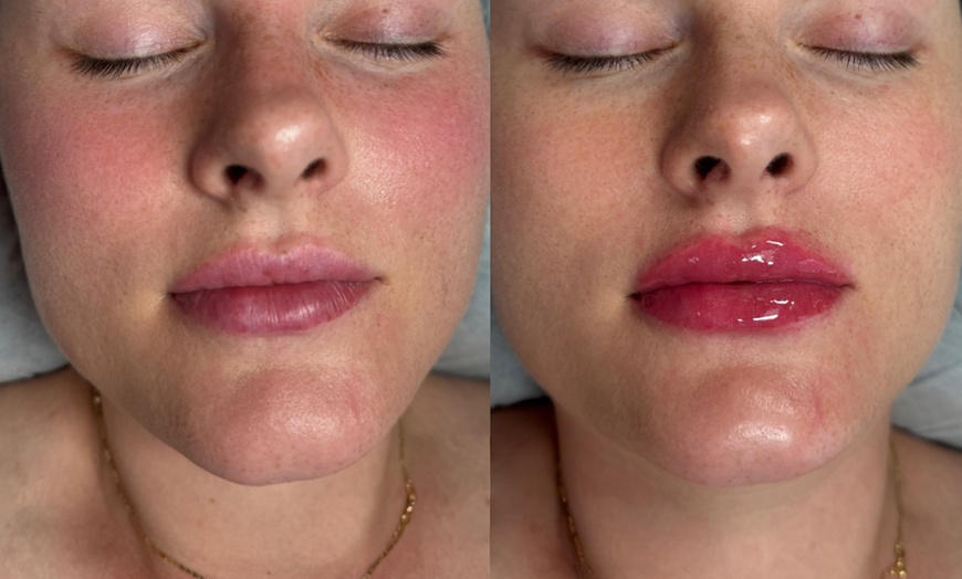Image 9: One Permanent Eyeliner, Lipblushing, Microblading or Powder Brows