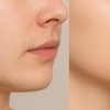 Image 2: 6 Laser Hair Removal Sessions-Small, Medium, Large or Extra Large Area