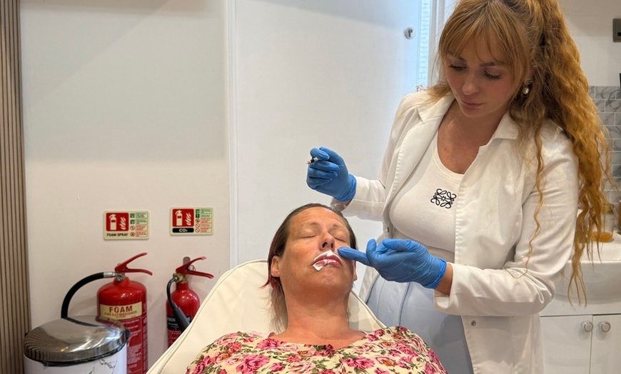 Image 2: Get a Session of 0.5ml/1.1ml Dermal Filler for Lips or Tear Trough